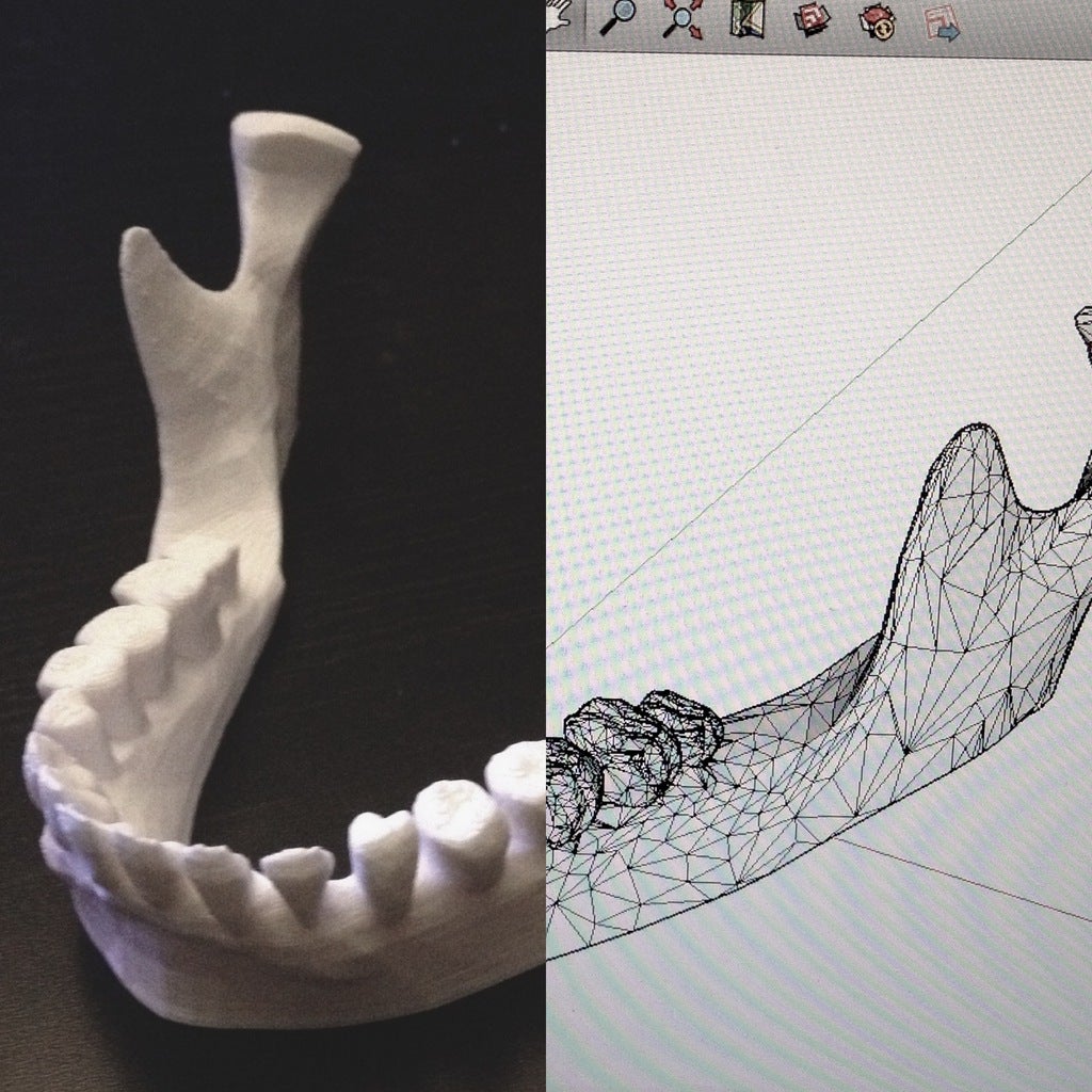 Jaw iPad Stand: Human Jaw Model and iPad Holder